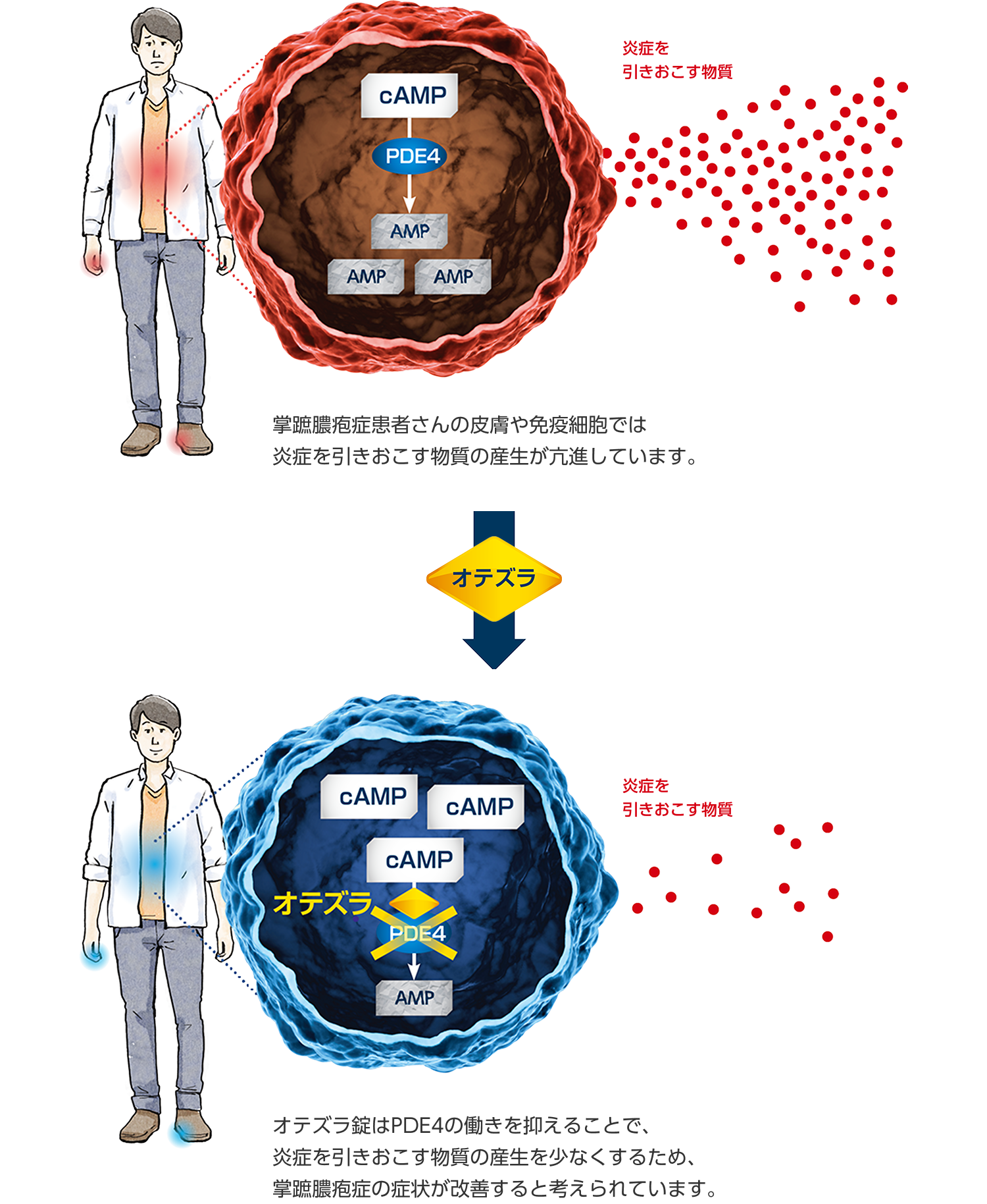 イメージ図：オテズラ錠が作用するしくみ